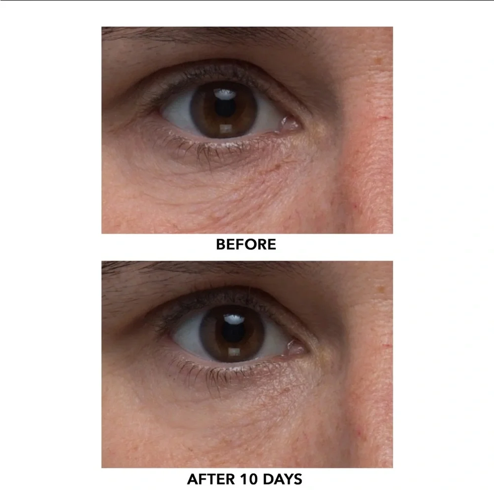 ALGENIST Triple Algae Eye Renewal Balm 0.5oz $68 NIB